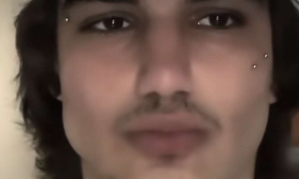1000059422