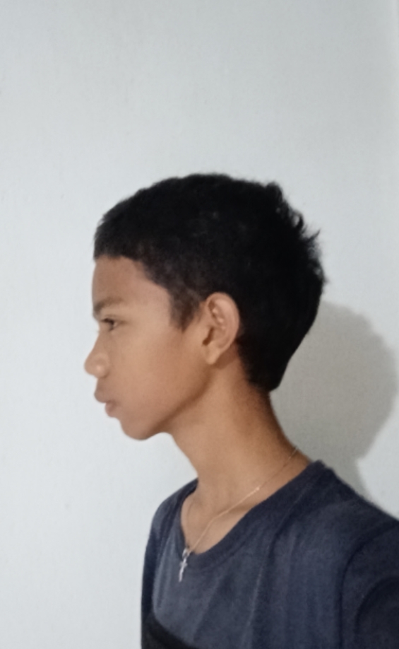 1000035690
