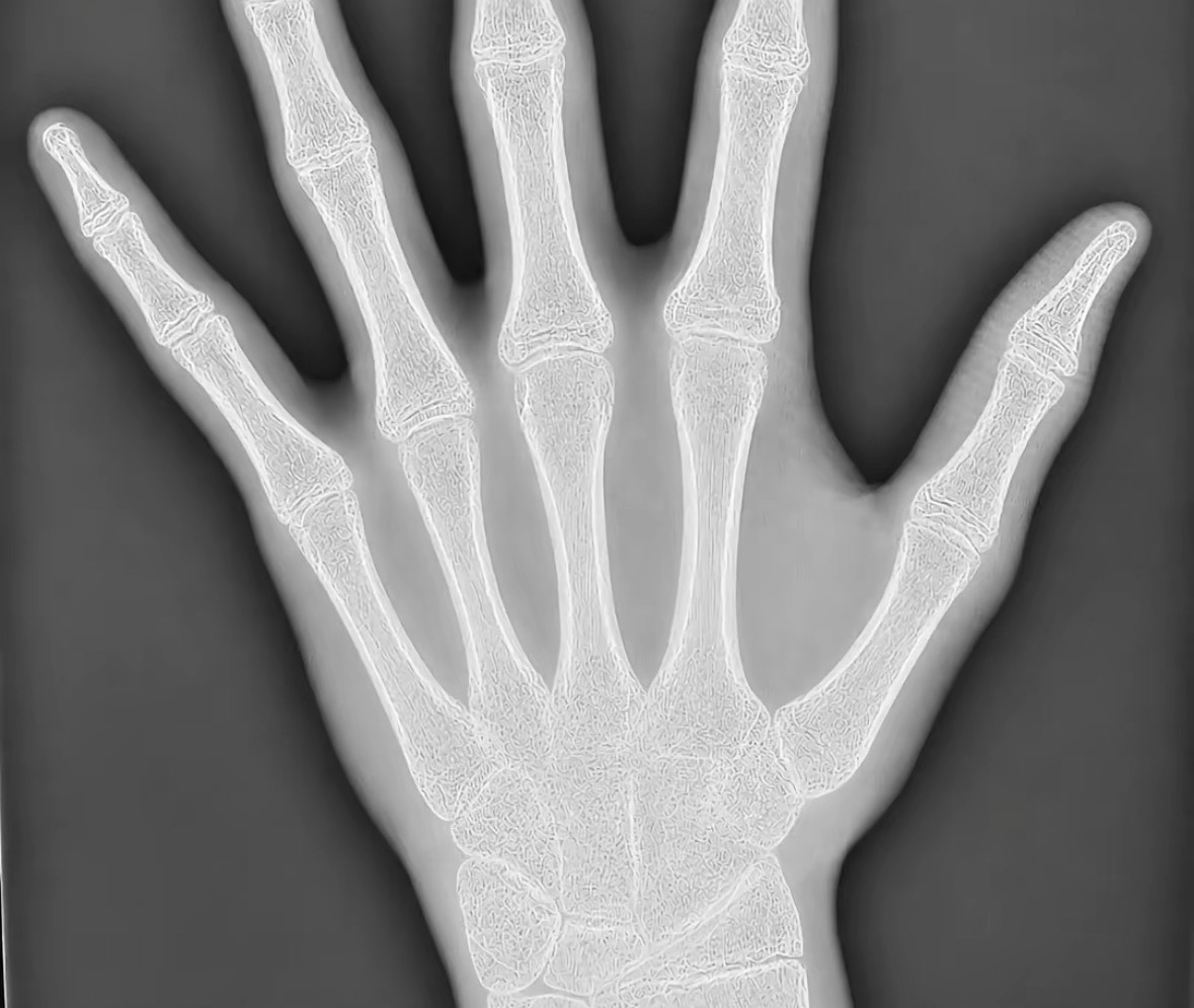 IMG 0187