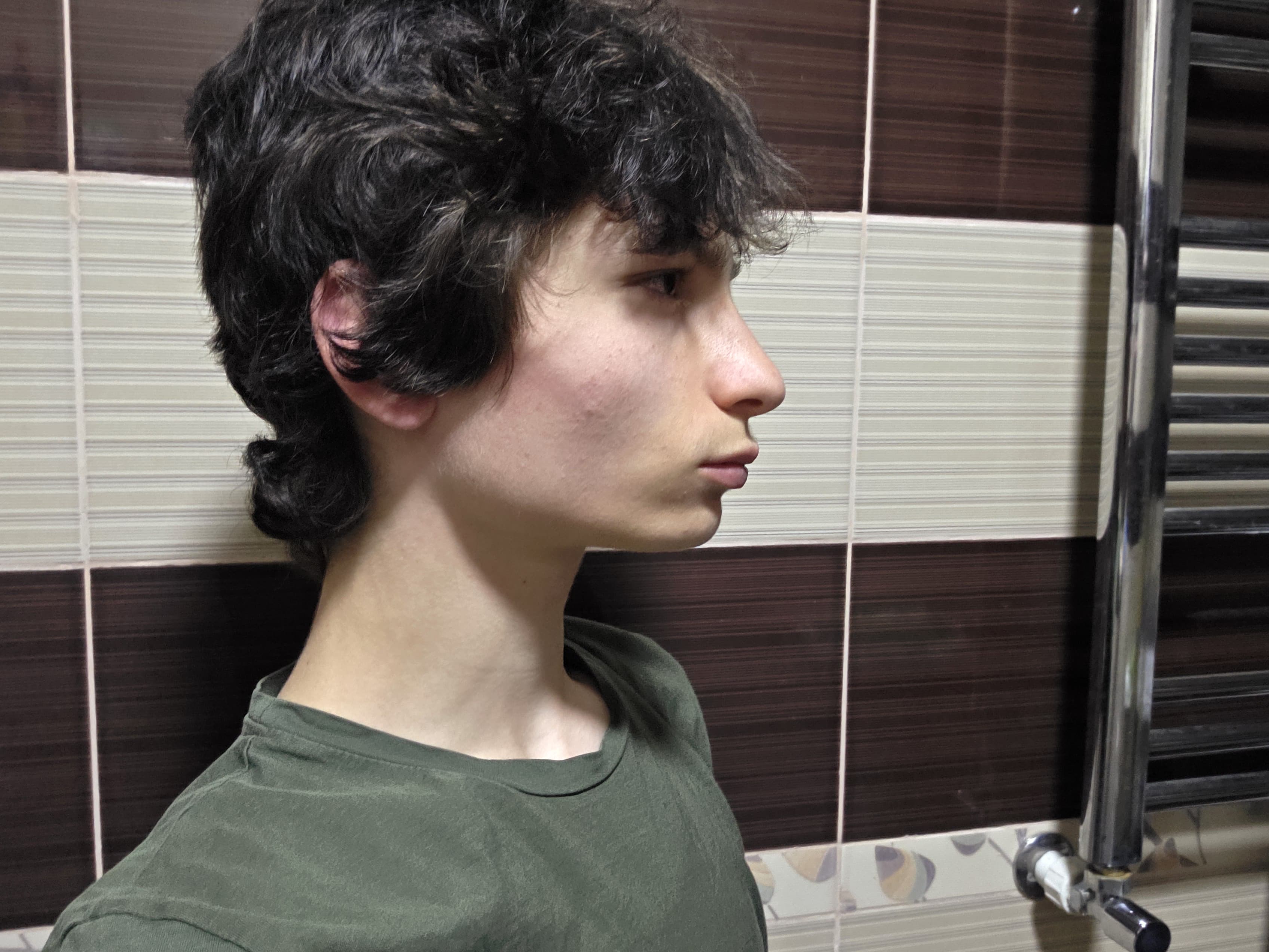 1000040151