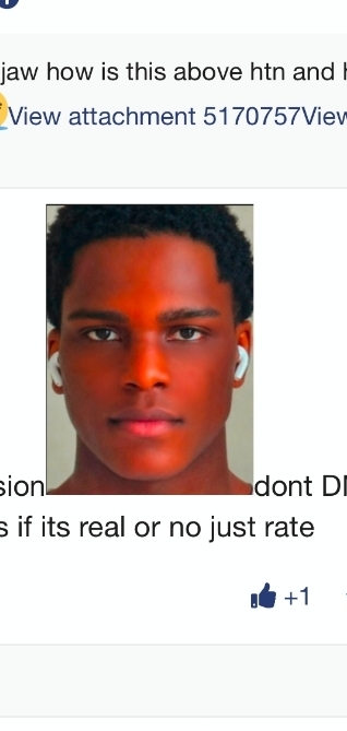 1000017657