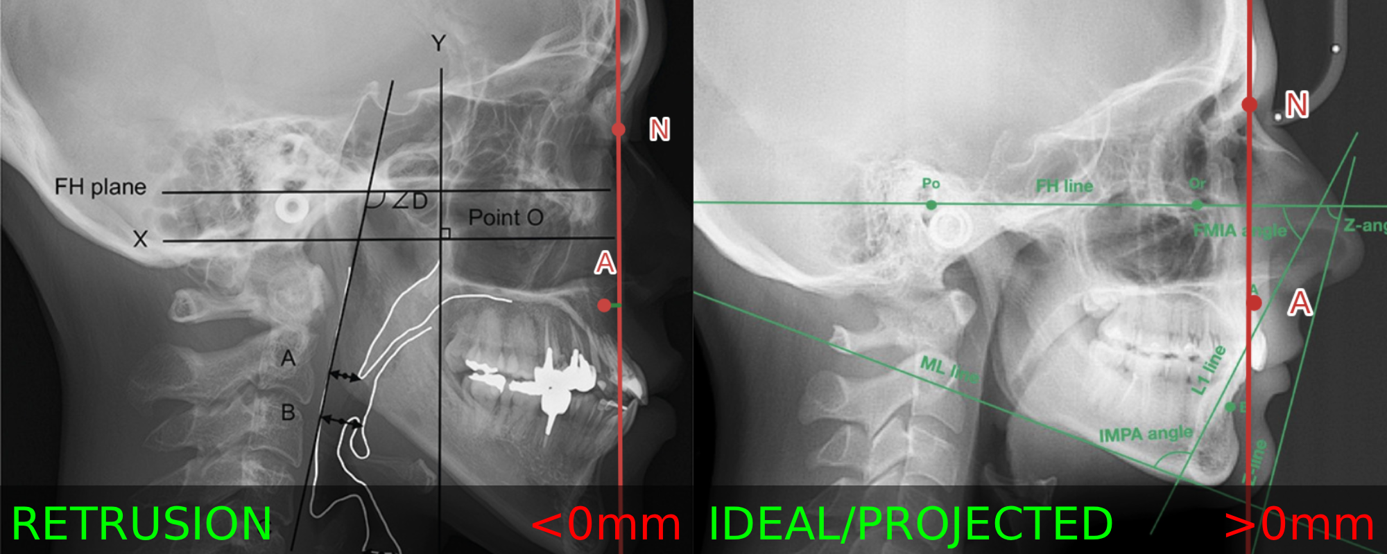 Nperp 1