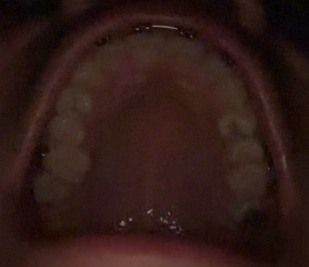 IMG 2907