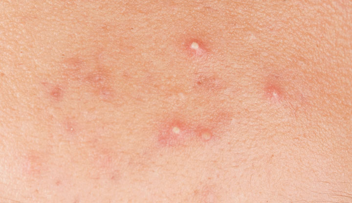 1780688418993