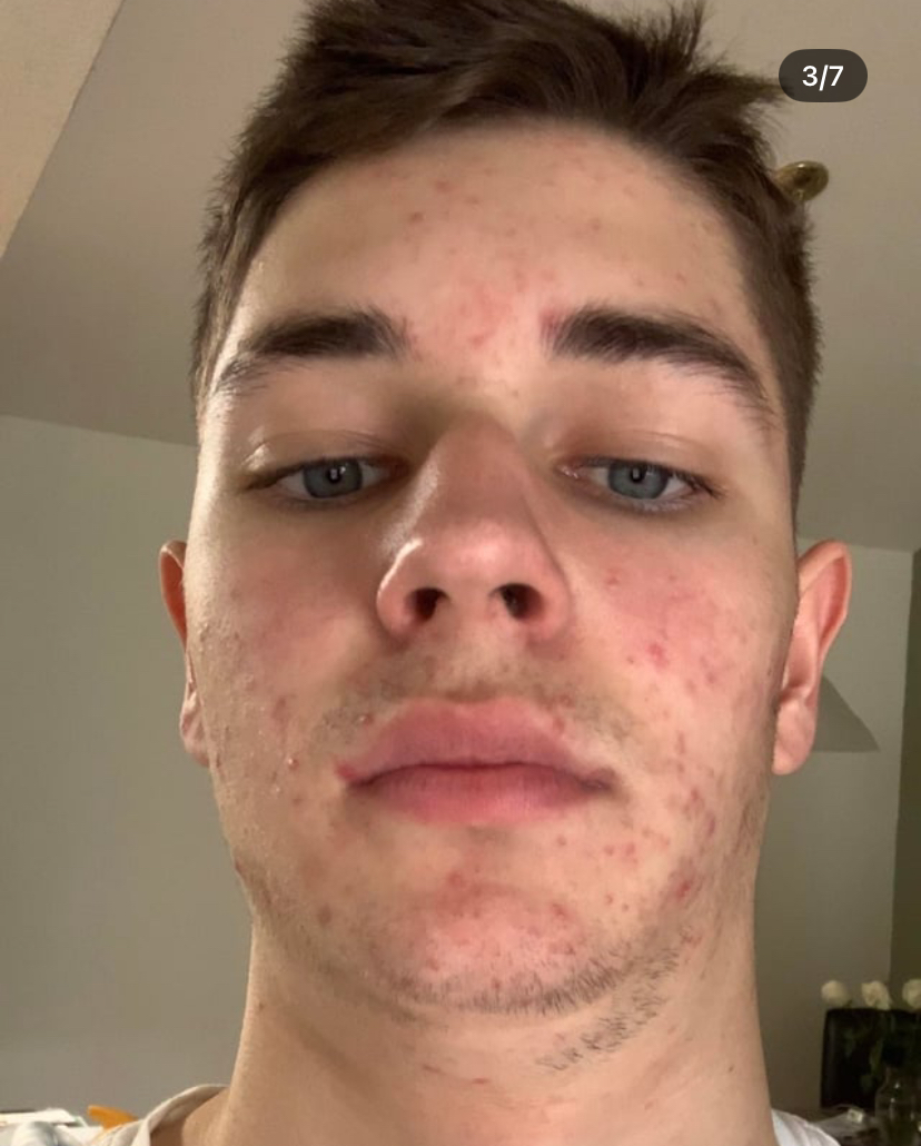 IMG 0561