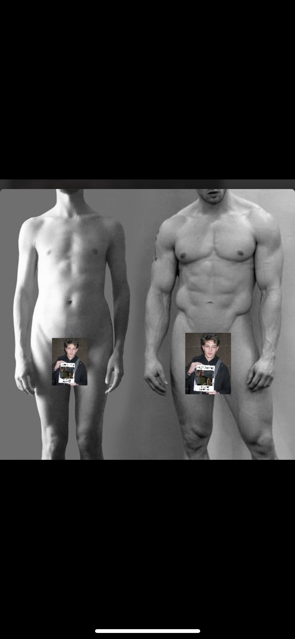 Hipcel fixed