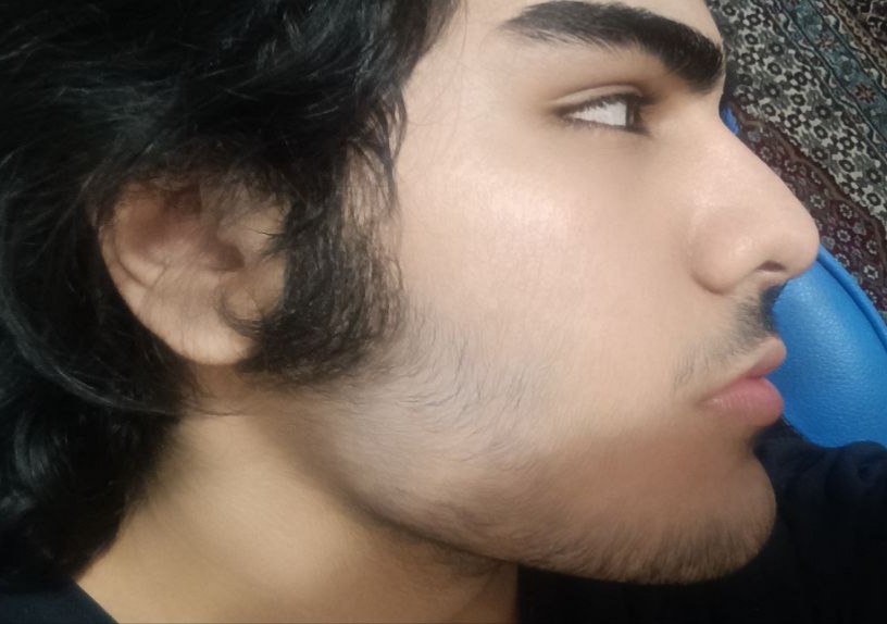 1000030575