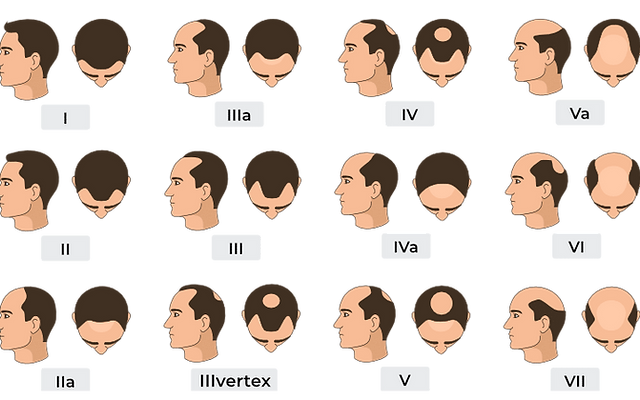 Man shedding hair