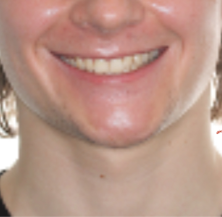 IMG 7715
