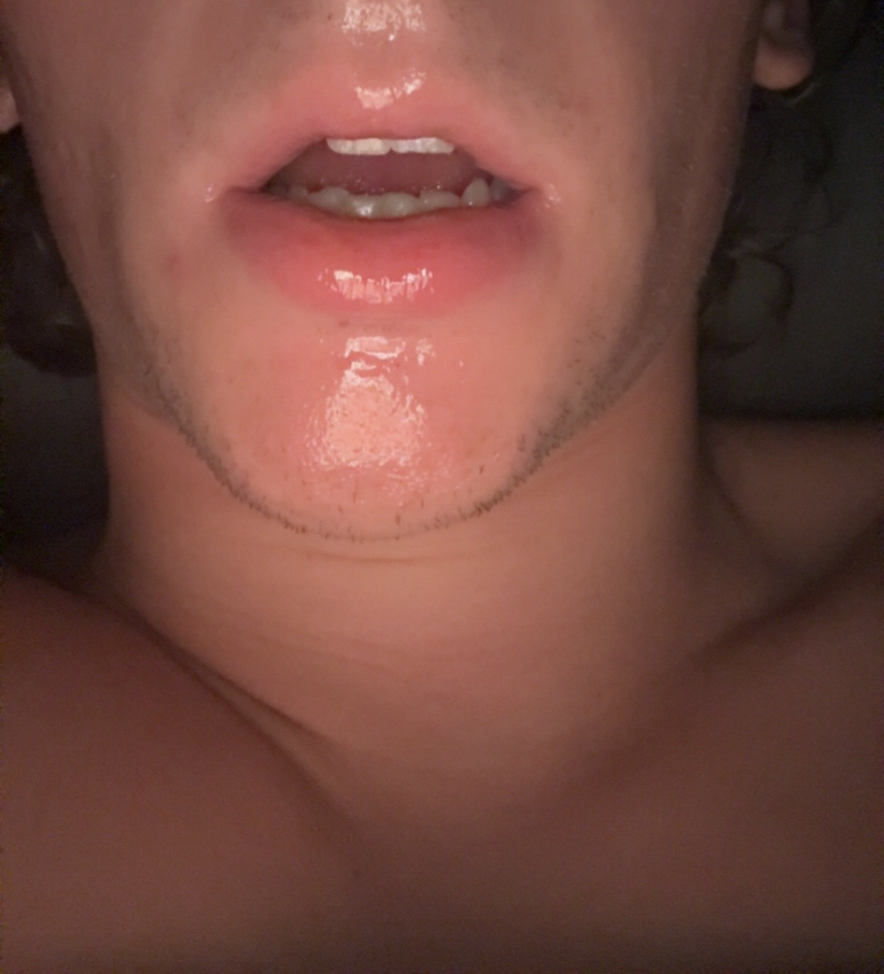 IMG 7720
