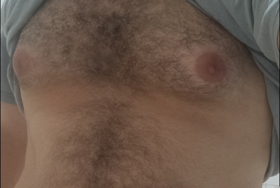 1000104079