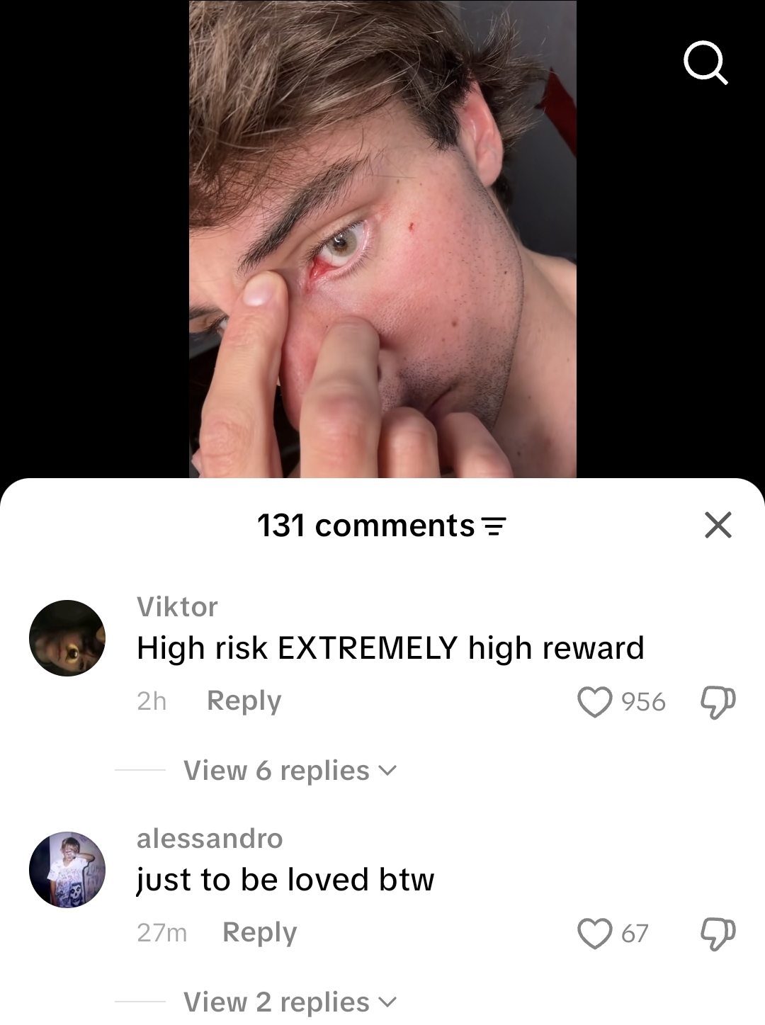 1000094155