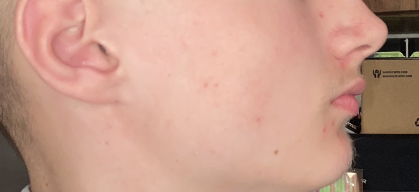 IMG 0450