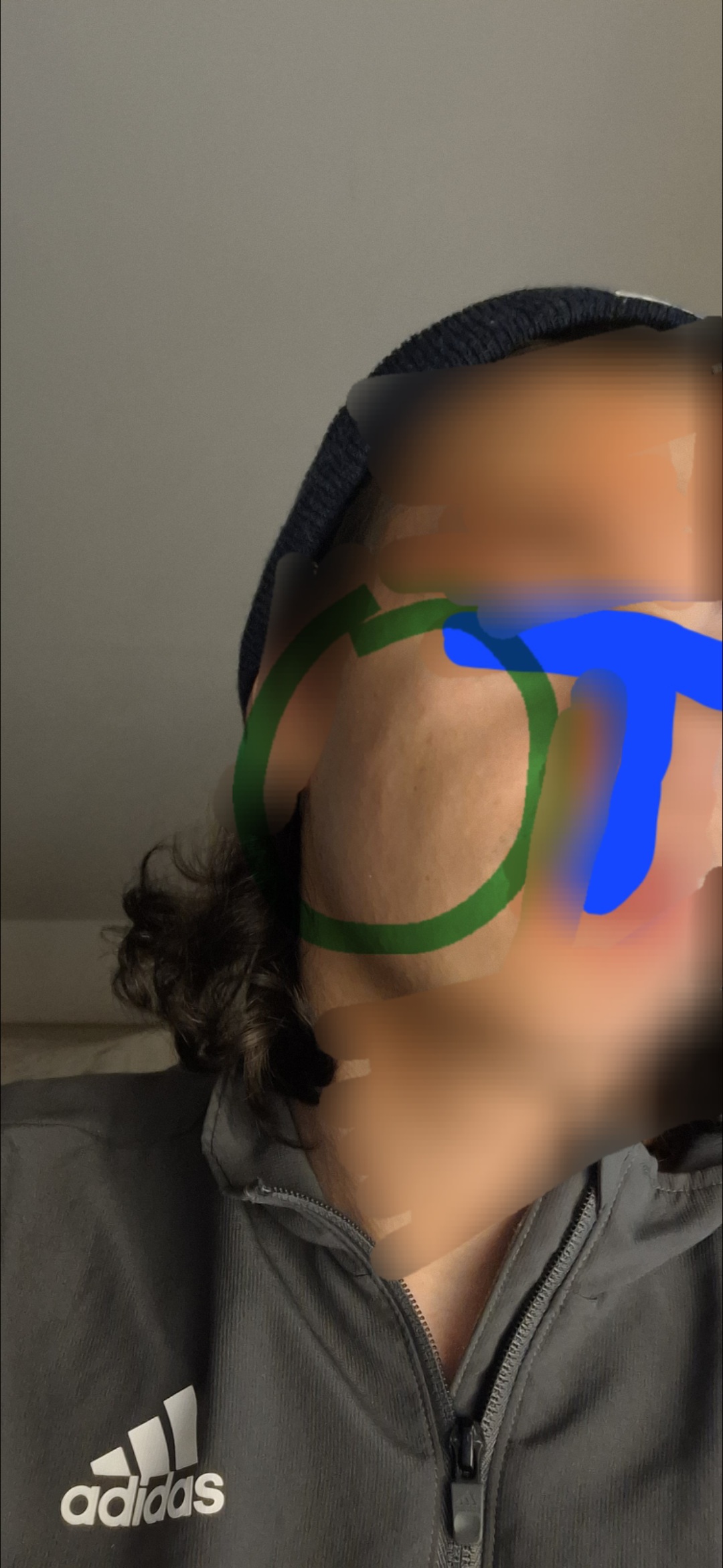 1000139135