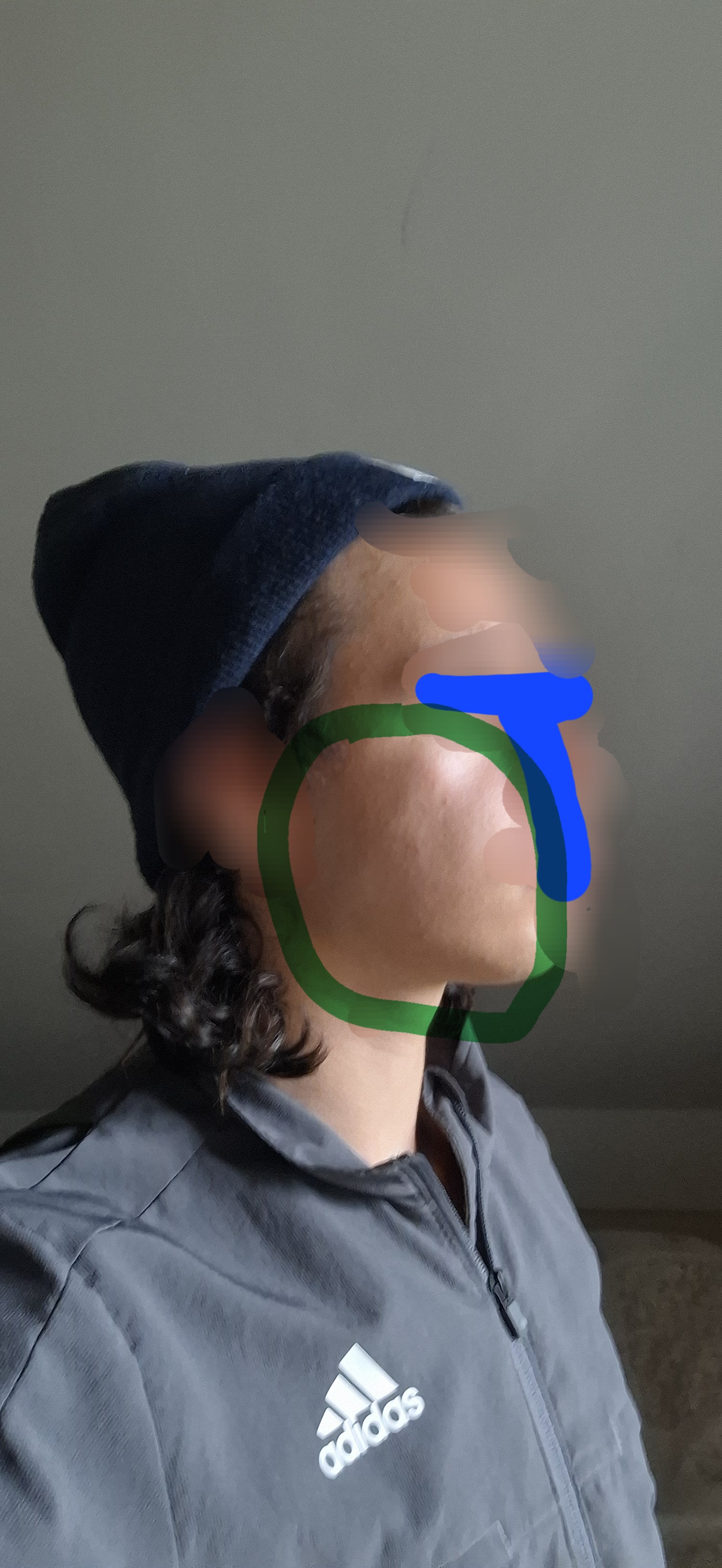1000139151