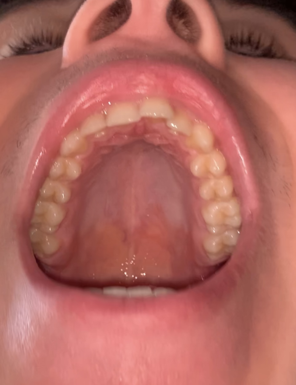 IMG 0825