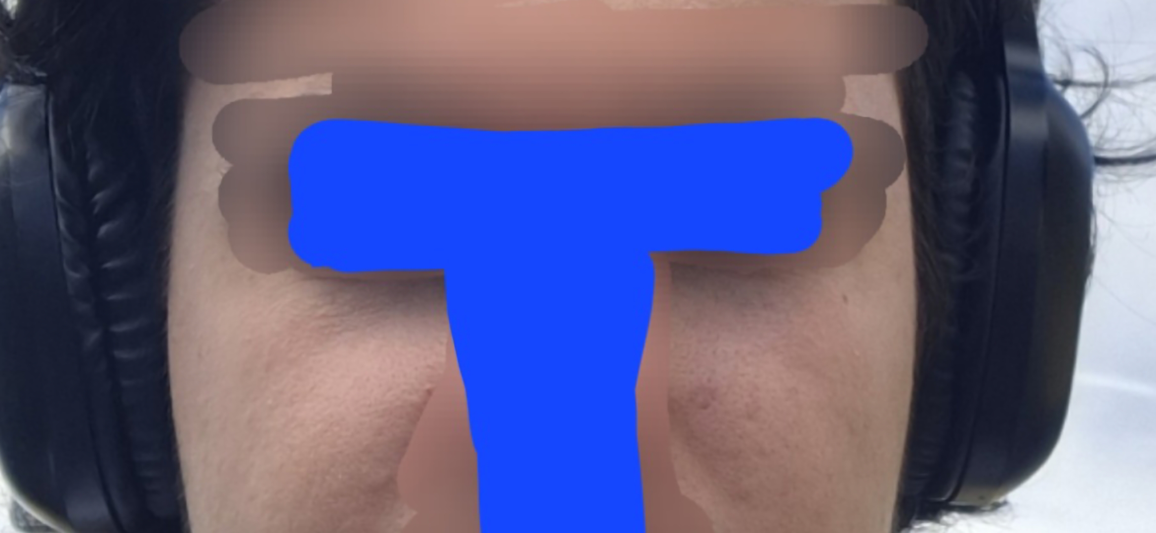 1000139474