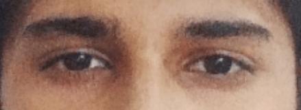 1000070866