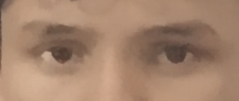 1000129665