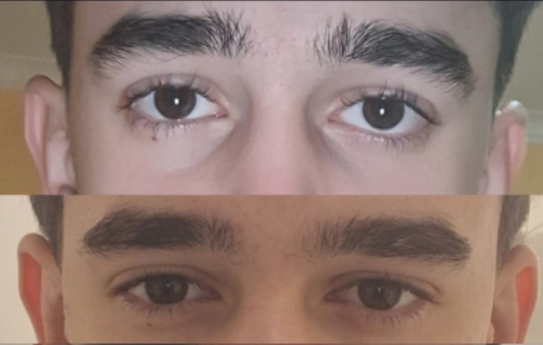 1000055084