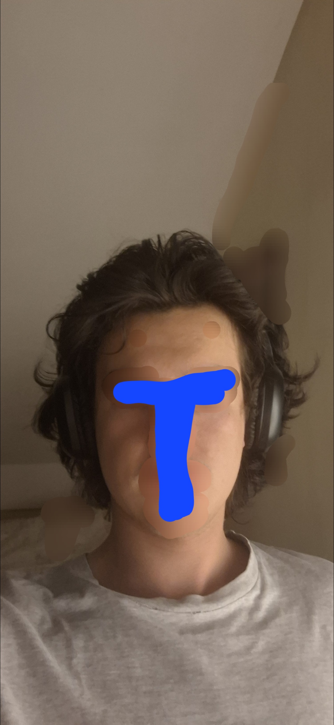1000140493