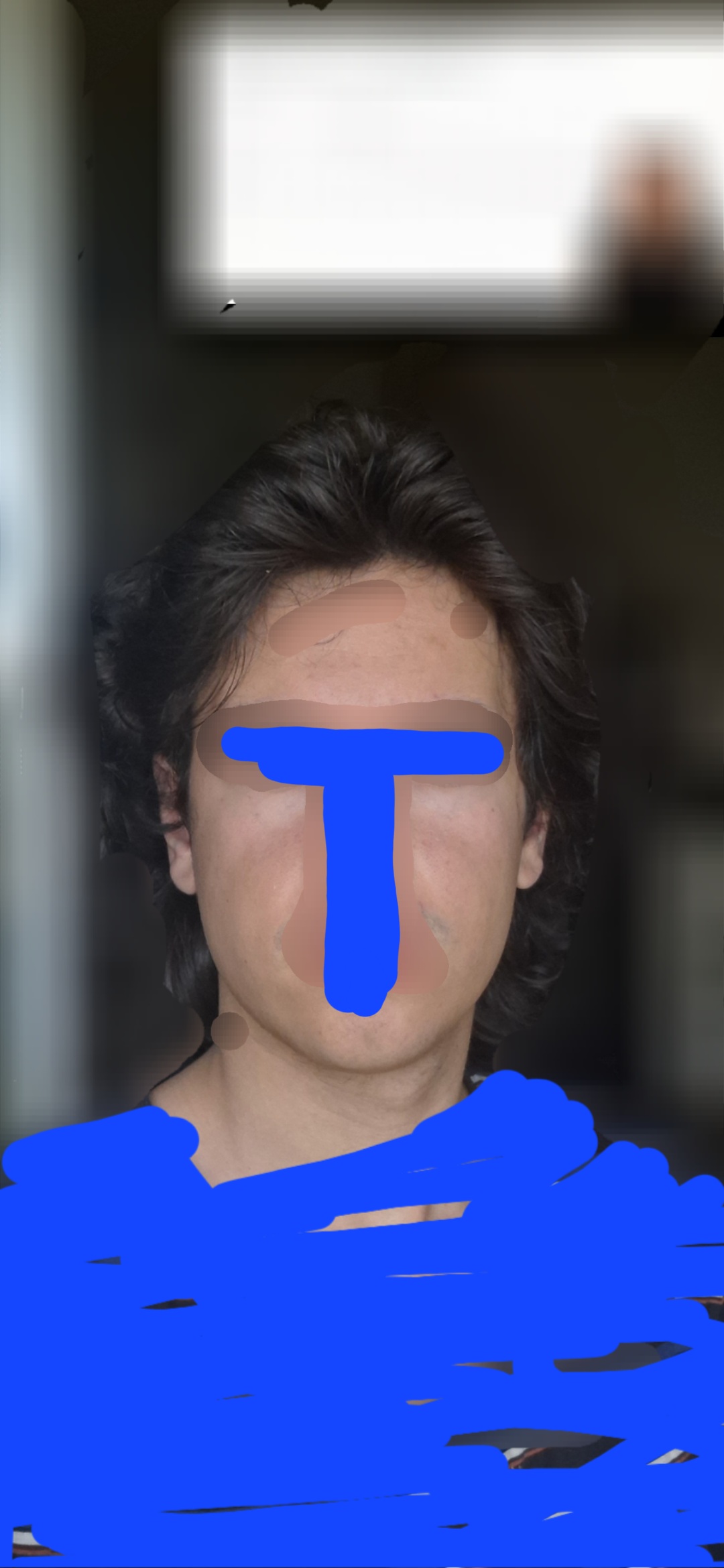 1000141671