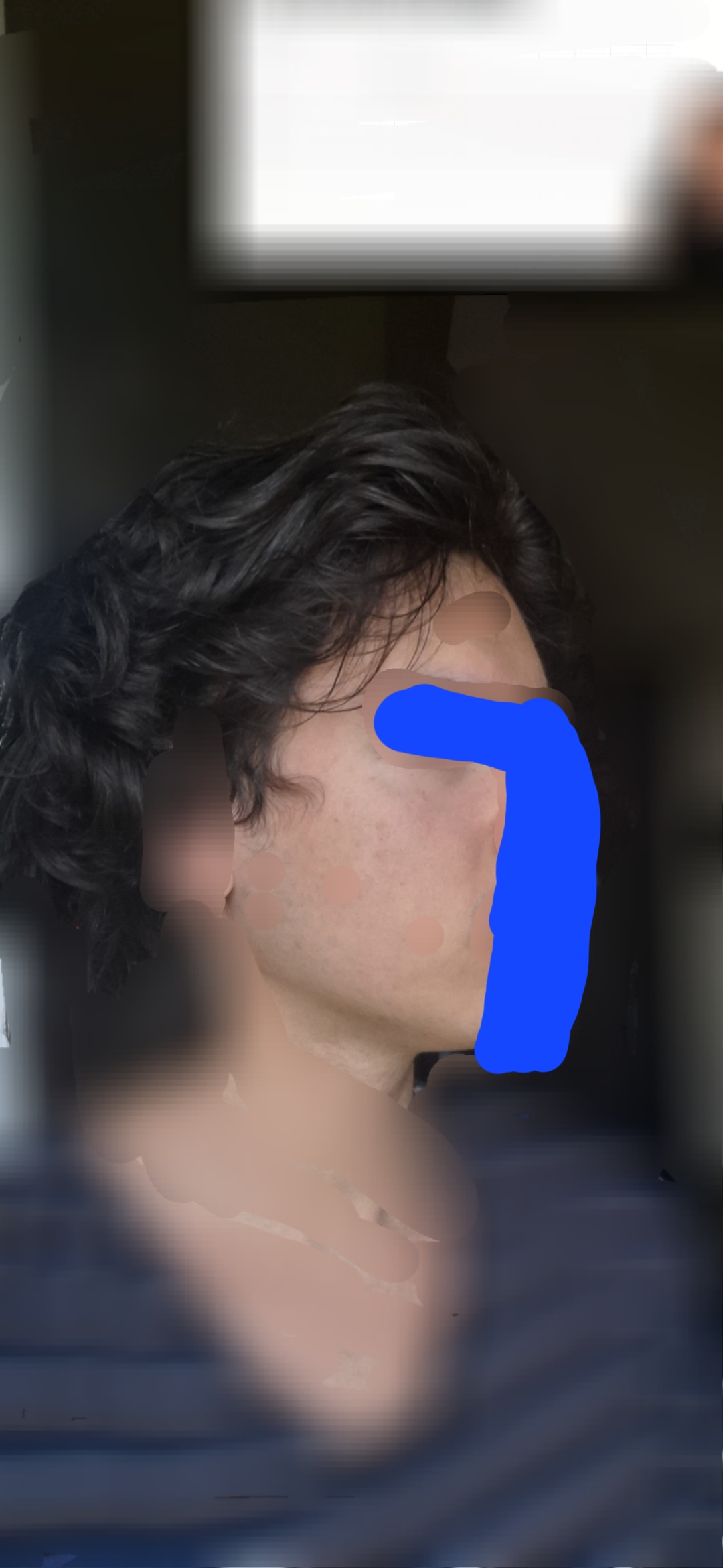 1000141670
