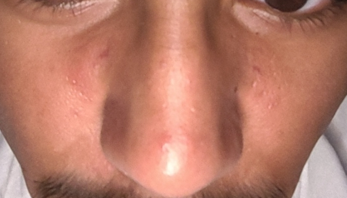 1000030537