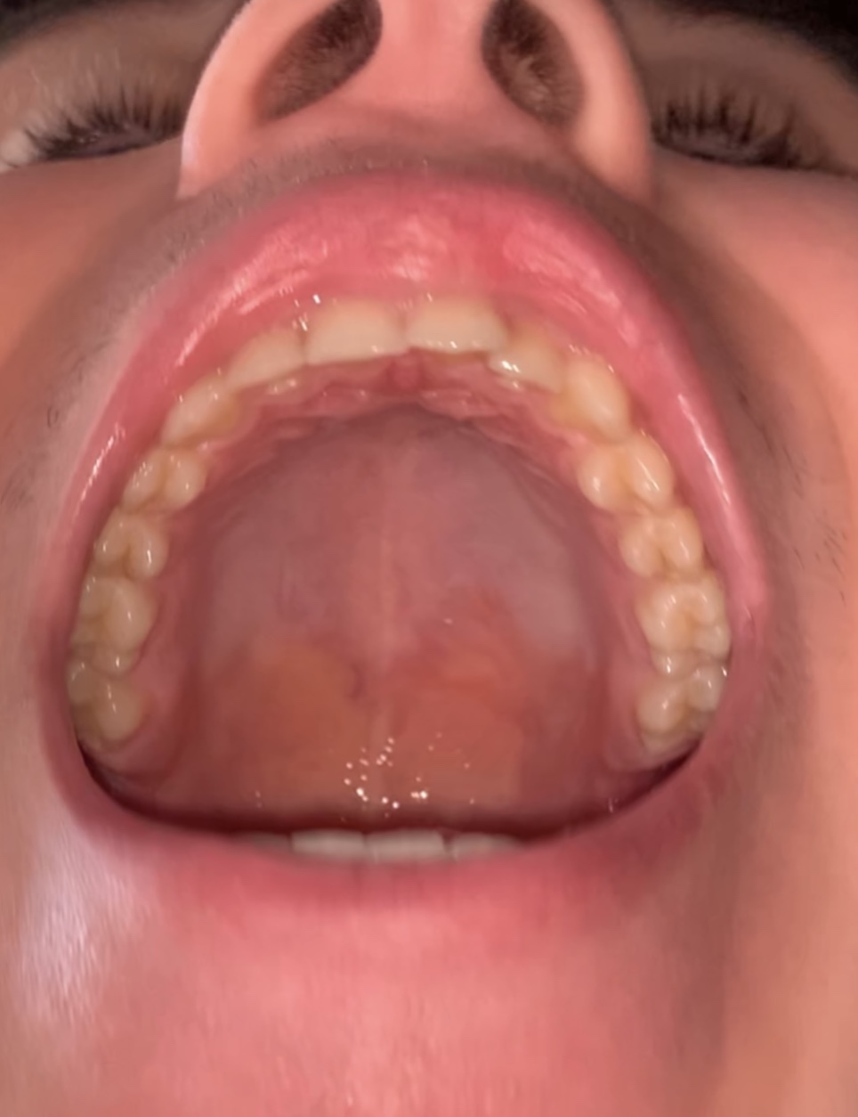 IMG 0853