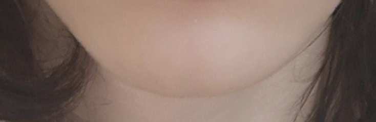 1000121395