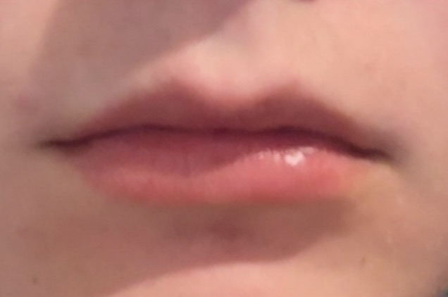 IMG 3654
