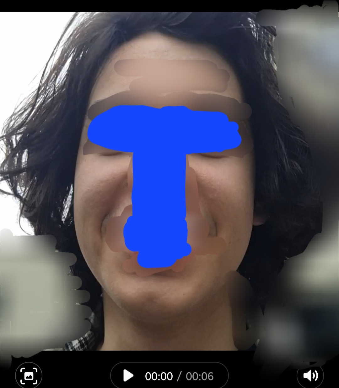 1000140581