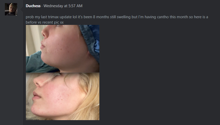 1781506915540