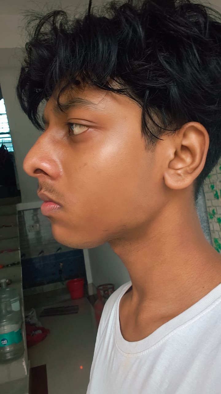 1000011261
