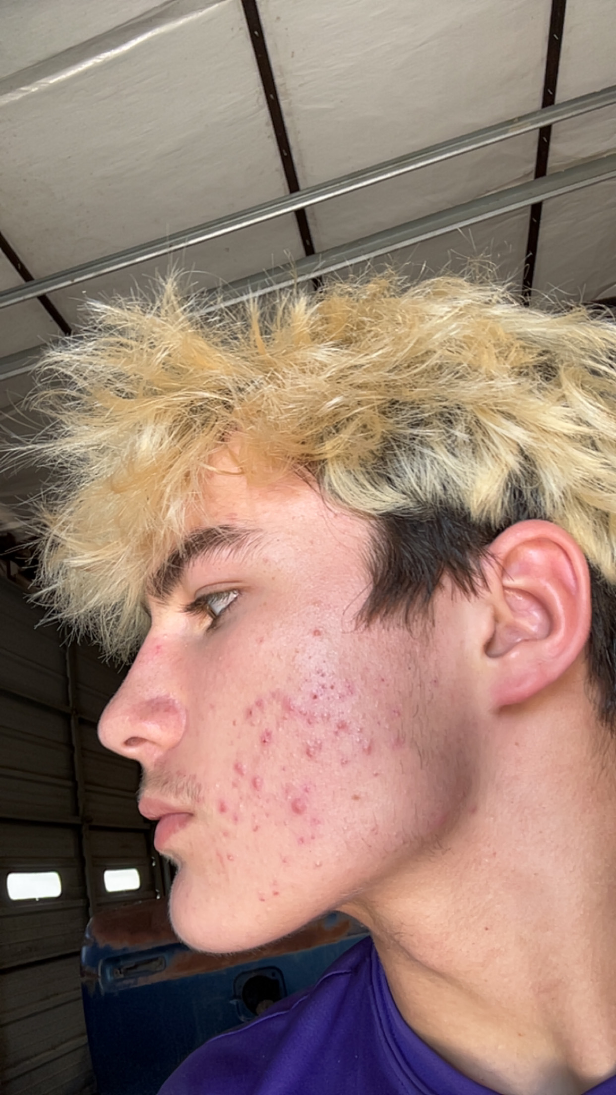 IMG 2310