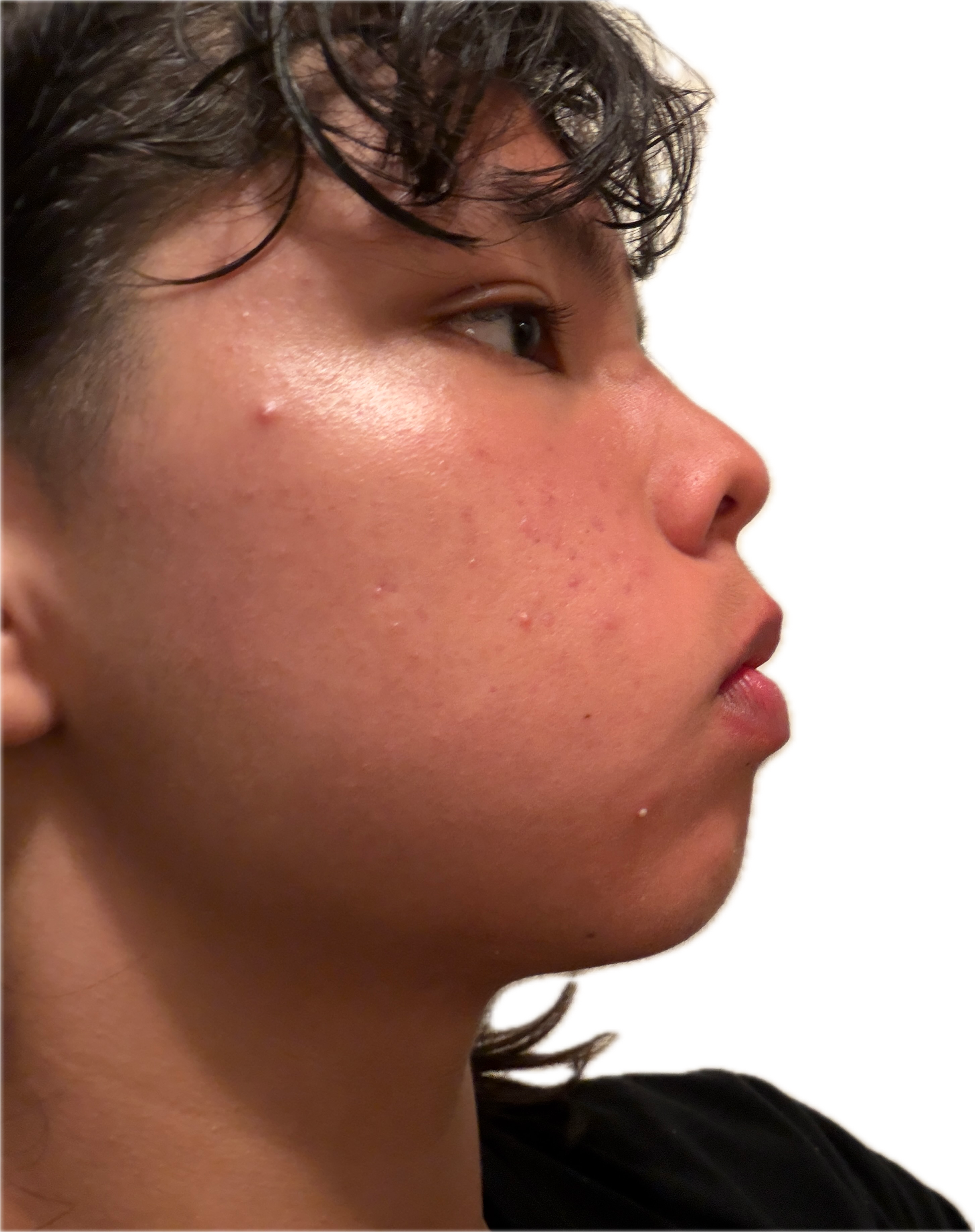 IMG 1522
