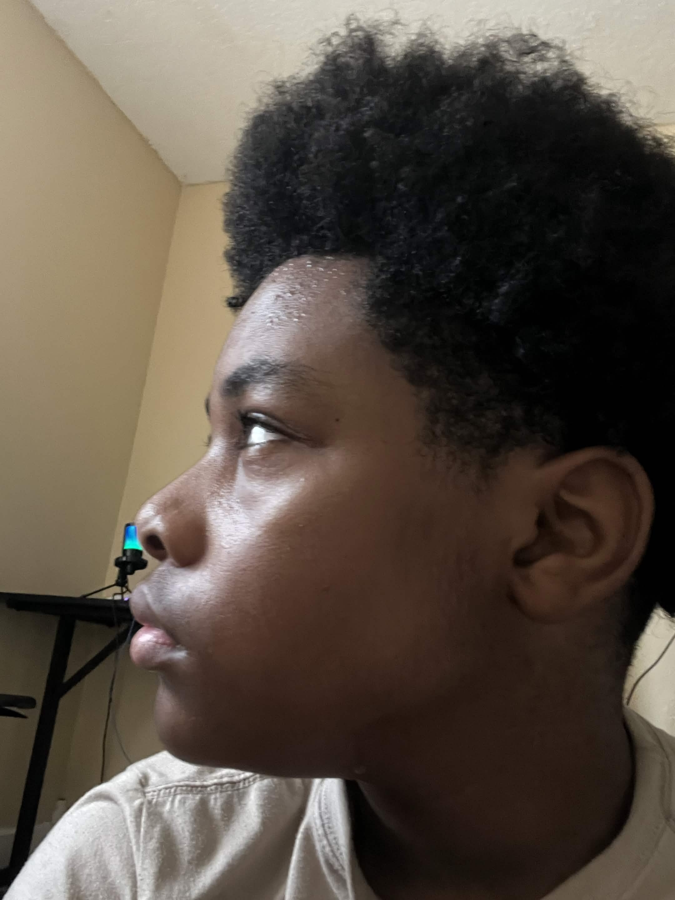 Side profile no ramus
