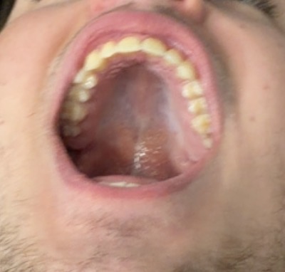 IMG 0121