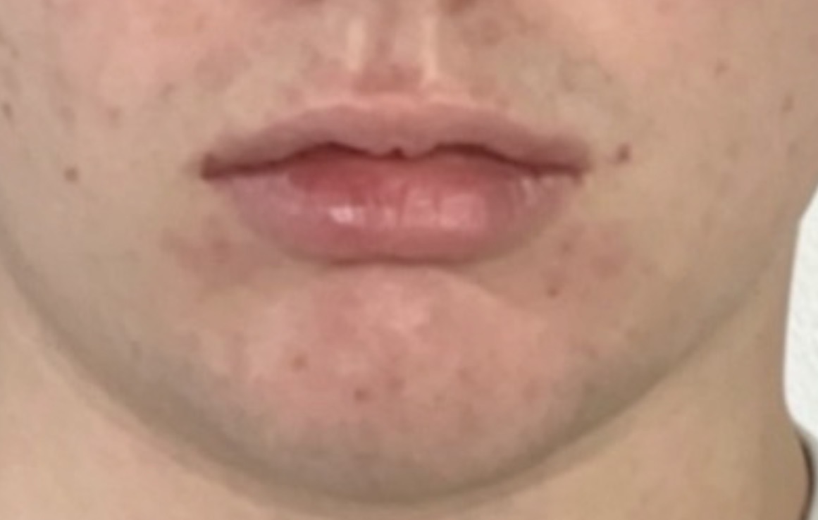 IMG 1136