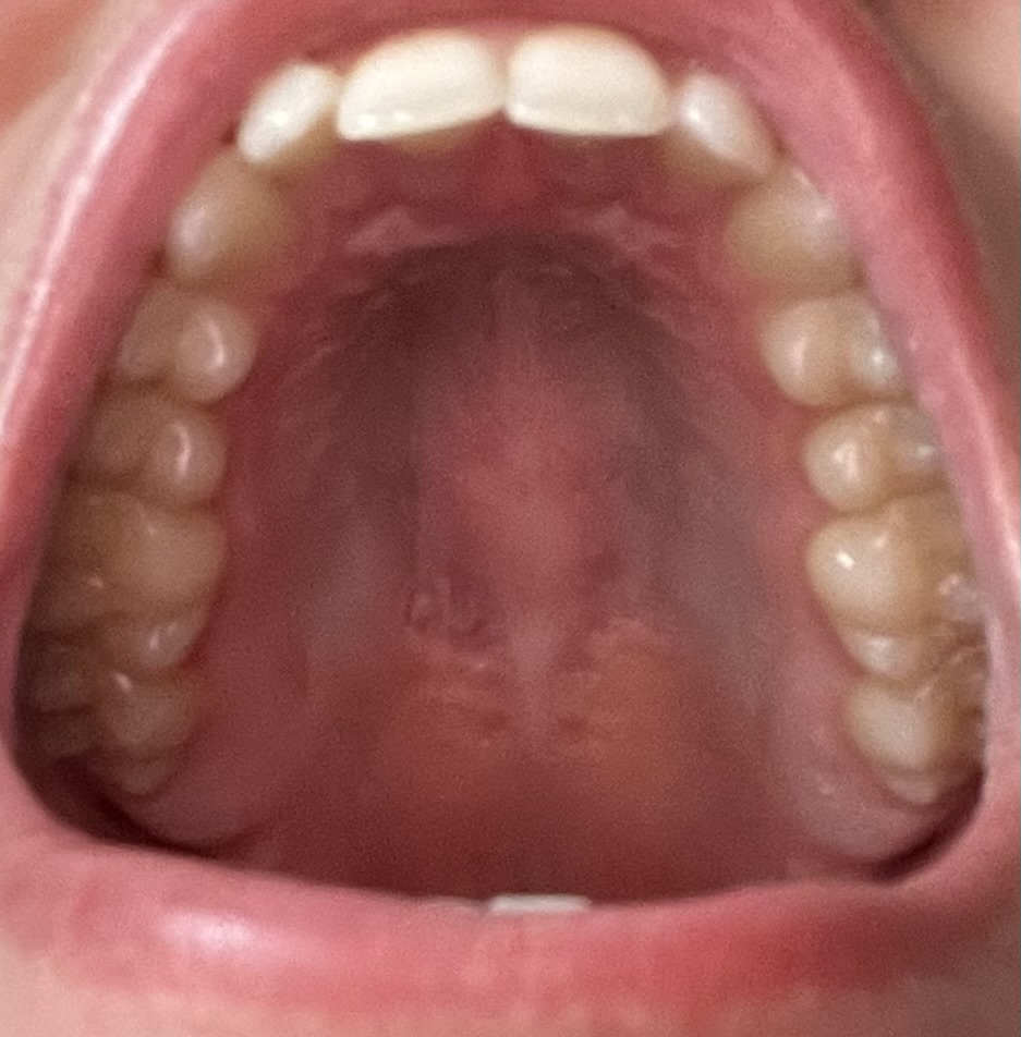IMG 3050