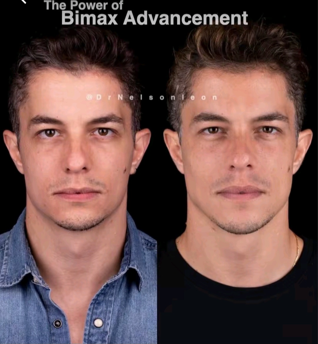 Screenshot 20260617 013944 TikTok