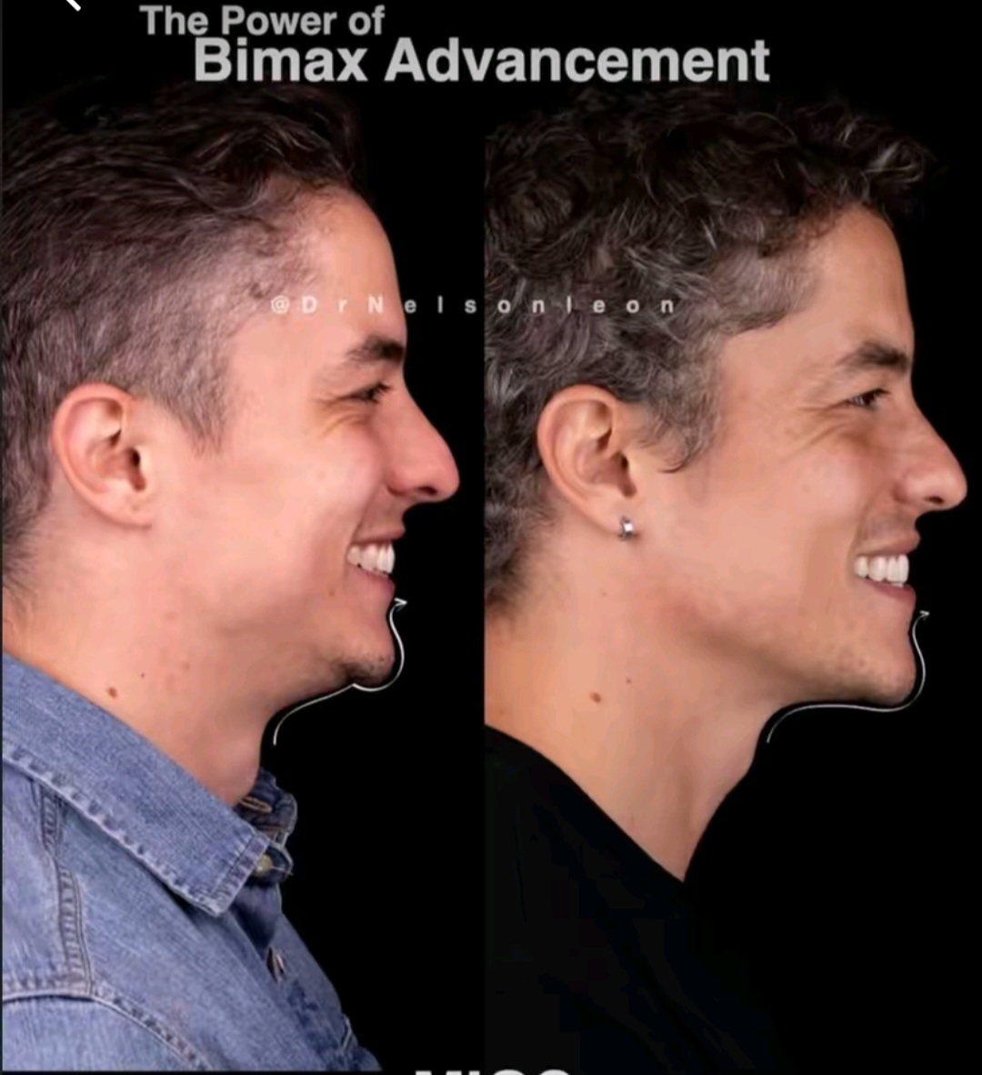 Screenshot 20260617 014010 TikTok