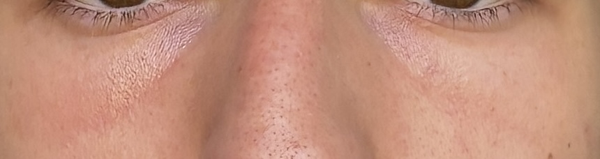 IMG 0803