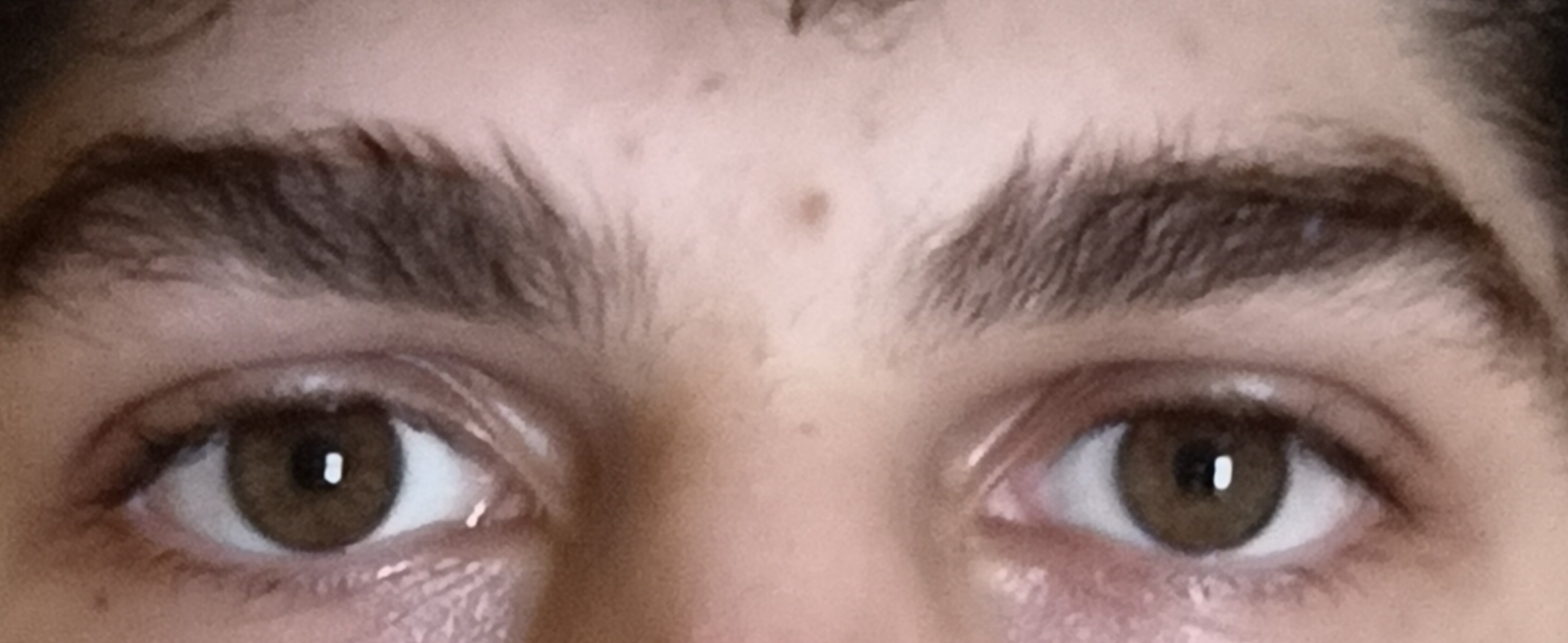 1000095692