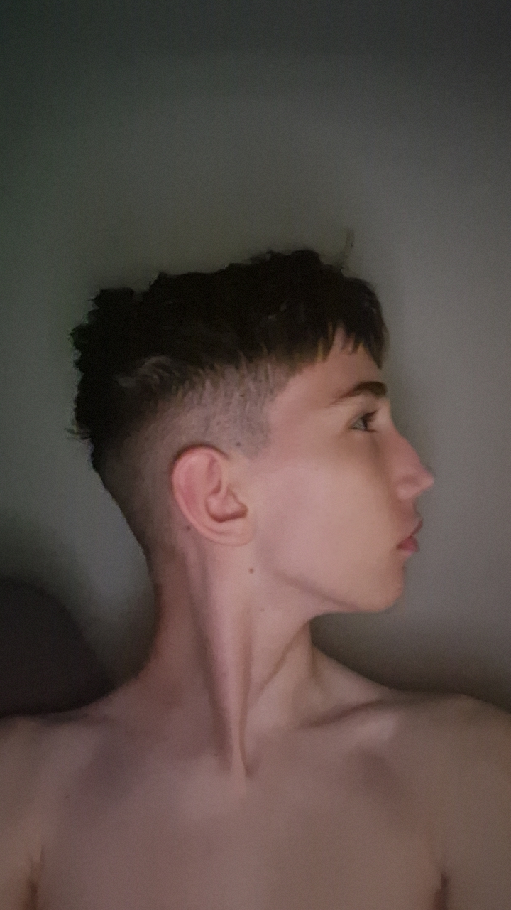 1000038710