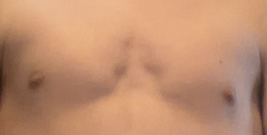 IMG 2639