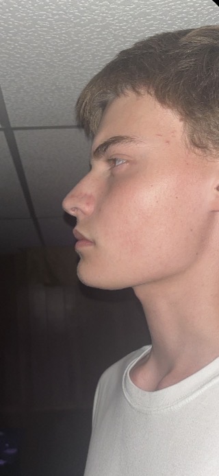 IMG 0885