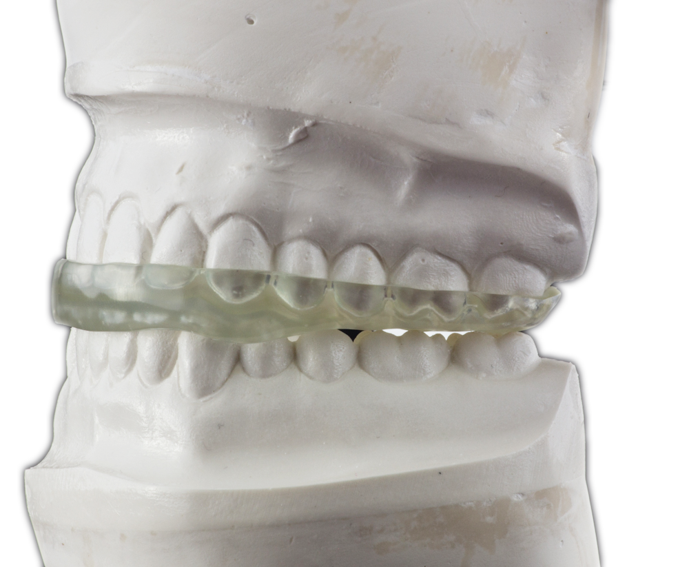 5acf1d5334193 hdl 155 of 195