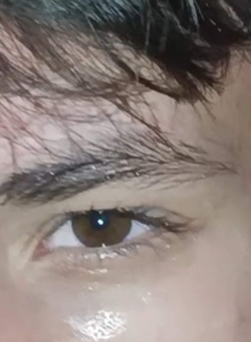 1000010604