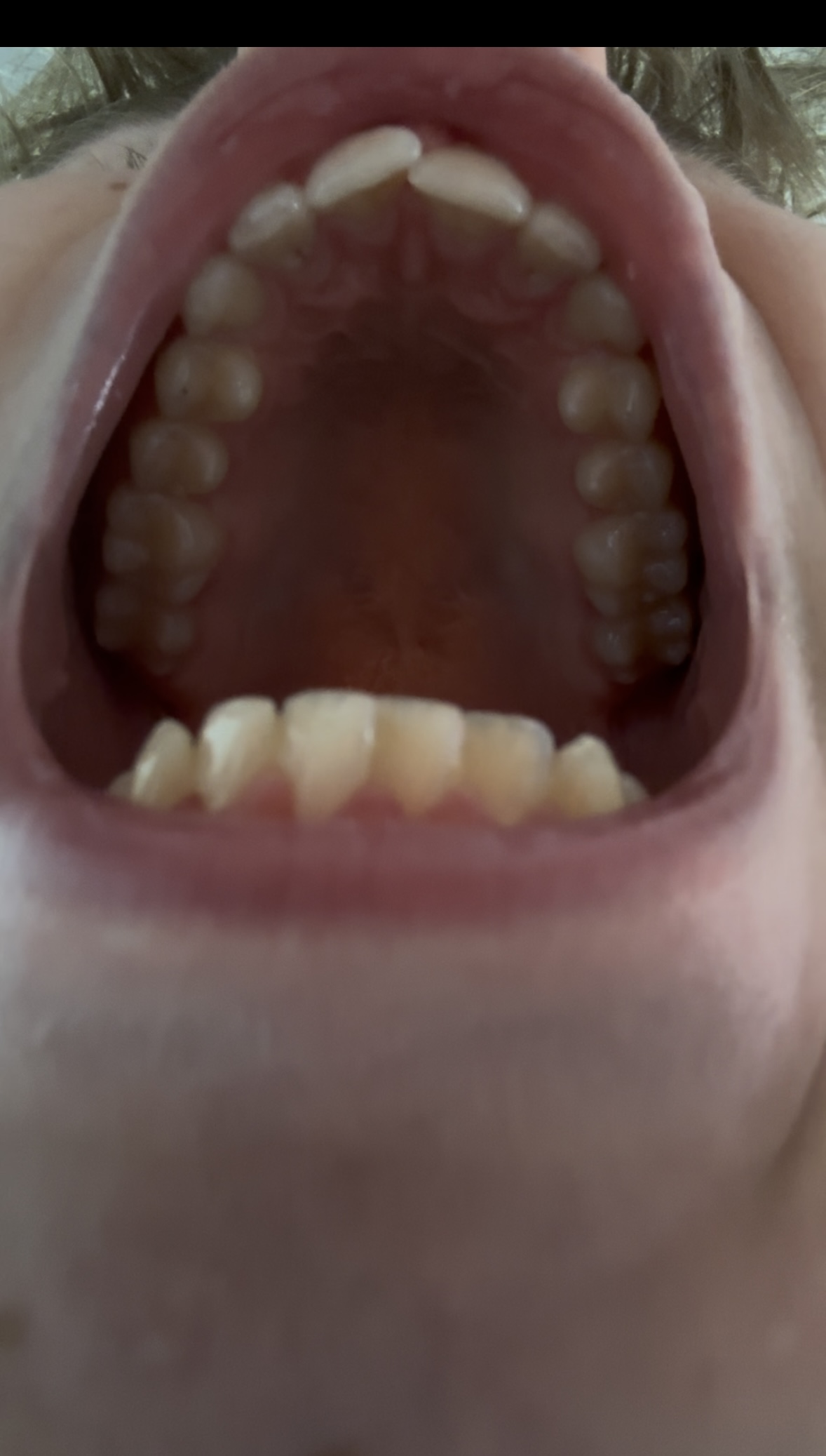 IMG 7235